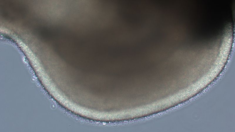Organoid in vitro